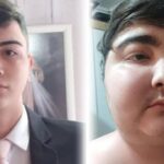 Tumor pequeno fez jovem ganhar 40 quilos em 6 meses - 25/06/2026 - Equilíbrio e Saúde