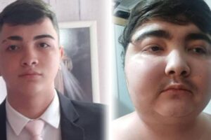 Tumor pequeno fez jovem ganhar 40 quilos em 6 meses - 25/06/2026 - Equilíbrio e Saúde