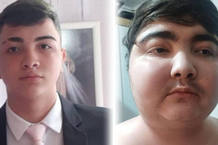 Tumor pequeno fez jovem ganhar 40 quilos em 6 meses - 25/06/2026 - Equilíbrio e Saúde