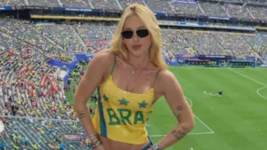 Celebridades que sofrem de alopecia e podem ficar carecas