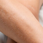Pele seca no inverno: dermatologistas dão dicas - 06/07/2026 - Equilíbrio