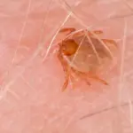 Febre maculosa mata 17 pessoas em São Paulo em 2026
